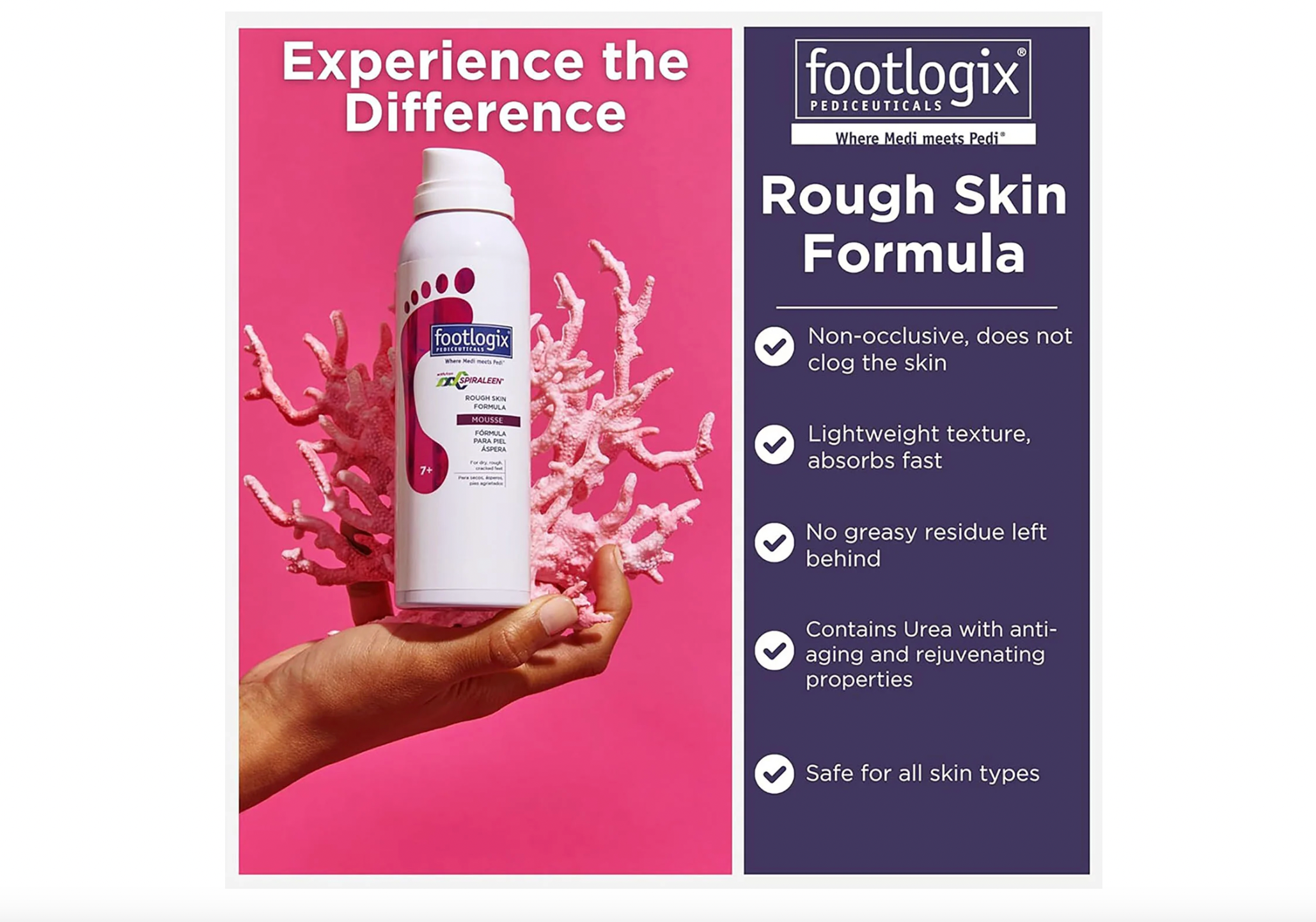 Footlogix Rough Skin Formula Mousse 4.23 oz.