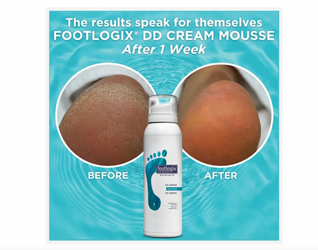 Footlogix #1 DD Cream Mousse 4.23 oz./119.9 g