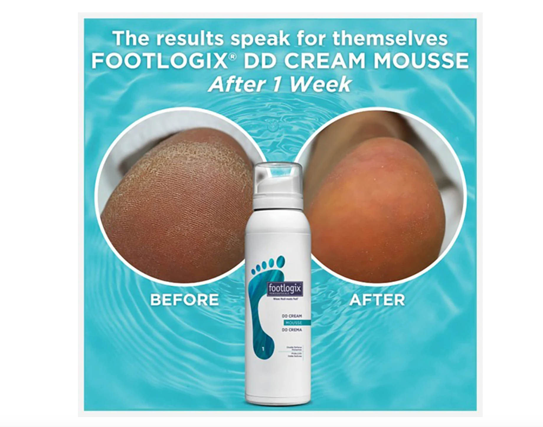 Footlogix #1 DD Cream Mousse 4.23 oz./119.9 g